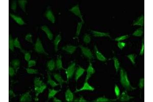 Immunofluorescent analysis of Hela cells using ABIN7145271 at dilution of 1:100 and Alexa Fluor 488-congugated AffiniPure Goat Anti-Rabbit IgG(H+L) (BATF3 抗体  (AA 2-65))