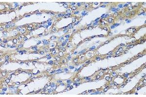 Immunohistochemistry of paraffin-embedded Mouse kidney using NQO2 Polyclonal Antibody at dilution of 1:100 (40x lens). (NQO2 抗体)