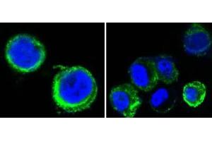 Confocal immunofluorescence analysis of methanol-fixed HEK293 cells trasfected with AXL-hIgGFc using AXL antibody (green), showing cytoplasmic and membrane localization. (AXL 抗体)