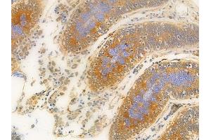 ABIN6261947 and ABIN6276873 at 1/100 staining human normal colon tissue by IHC-P. (GGT1 抗体  (N-Term))