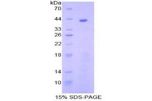 SDS-PAGE analysis of Human C8b Protein. (C8B 蛋白)