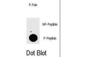 Dot Blot (DB) image for anti-TGF-beta Activated Kinase 1/MAP3K7 Binding Protein 1 (TAB1) (pSer423) antibody (ABIN5021453) (TAB1 抗体  (pSer423))