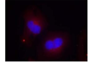 Image no. 2 for anti-PTK2 Protein tyrosine Kinase 2 (PTK2) (pTyr925) antibody (ABIN196825) (FAK 抗体  (pTyr925))