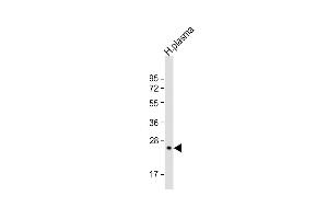 Anti-CFD Antibody (N-term)at 1:2000 dilution + human plasma lysates Lysates/proteins at 20 μg per lane. (Adipsin 抗体  (N-Term))