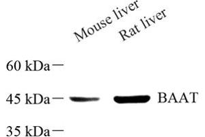 Western blot analysis of BAAT (ABIN7073212) at dilution of 1: 500 (BAAT 抗体)