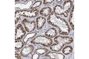 Immunohistochemical staining of human kidney with COBL polyclonal antibody  shows strong granular cytoplasmic positivity in tubular cells at 1:200-1:500 dilution. (COBL 抗体)