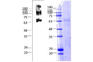 Human Melanocortin 4 Receptor (MC4R) (AA 1-332), Fraction 10-12
