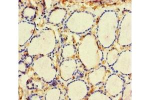 Immunohistochemistry of paraffin-embedded human thyroid tissue using ABIN7161000 at dilution of 1:100 (ME3 抗体  (AA 547-598))
