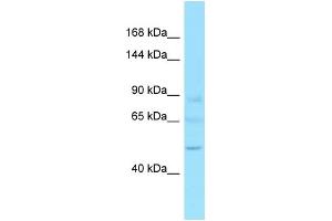 Western Blotting (WB) image for anti-GTF2I Repeat Domain Containing 2 (GTF2IRD2) (C-Term) antibody (ABIN2789098)