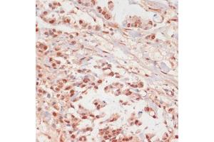 Immunohistochemistry (IHC) image for anti-Protein Phosphatase 1, Catalytic Subunit, alpha Isoform (PPP1CA) (pThr320) antibody (ABIN7269674)