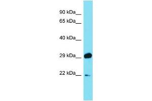 Host: Rabbit Target Name: PGAM1 Sample Type: Fetal Brain lysates Antibody Dilution: 1. (PGAM1 抗体  (C-Term))