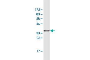 Western Blot detection against Immunogen (37. (ZBTB14/ZFP161 抗体  (AA 311-420))