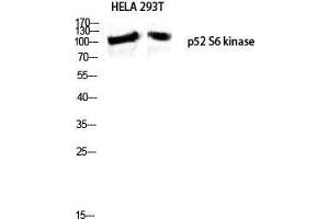 Western Blot (WB) analysis of HeLa 293T lysis using p52 S6 kinase antibody. (RPS6KC1 抗体  (Internal Region))