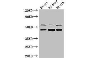 Western Blot Positive WB detected in: Mouse heart tissue, , Mouse kidney tissue, Mouse brain tissue All lanes: HNF4A antibody at 3 μg/mL Secondary Goat polyclonal to rabbit IgG at 1/50000 dilution Predicted band size: 53, 52, 47, 57, 51, 49, 44 kDa Observed band size: 53, 47 kDa (HNF4A 抗体  (AA 130-330))