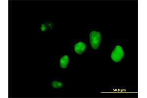 Immunofluorescence of purified MaxPab antibody to IFI16 on HeLa cell. (IFI16 抗体  (AA 1-729))