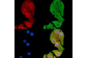 ABIN7095359 and ABIN7099416 staining Hela cells by IF/ICC.