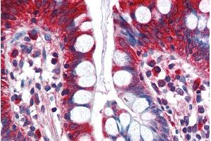 ABIN185632 (5µg/ml) staining of paraffin embedded Human Small Intestine. (ACSL5 抗体  (C-Term))