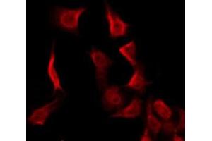 Immunofluorescence (fixed cells) (IF/ICC) image for anti-Melanocortin 2 Receptor (Adrenocorticotropic Hormone) (MC2R) (N-Term) antibody (ABIN6258657)