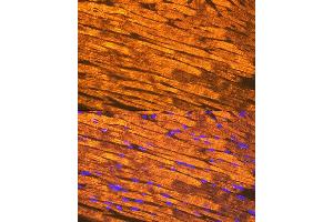 Immunofluorescence analysis of mouse heart using Tropomyosin 1 Rabbit mAb (ABIN7271013) at dilution of 1:100 (40x lens). (Tropomyosin 抗体)