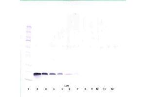 Image no. 2 for anti-Vascular Endothelial Growth Factor A (VEGFA) antibody (ABIN465336) (VEGFA 抗体)