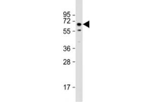 Western blot testing of mouse testis lysate with TOR1AIP1 antibody at 1:2000. (TOR1AIP1 抗体  (AA 42-76))