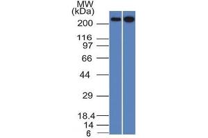 Western Blotting (WB) image for anti-Spectrin, Beta, Non-erythrocytic 2 (SPTBN2) (AA 356-475) antibody (ABIN6940651)