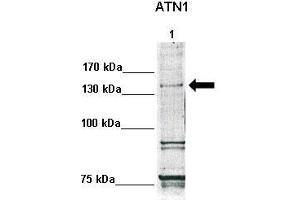 WB Suggested Anti-ATN1 Antibody  Positive Control: Lane1: 30ug human fibroblasts  Primary Antibody Dilution :  1:500 Secondary Antibody :  Anti-rabbit-HRP  Secondry Antibody Dilution :  1:1000 Submitted by: Anonymous (Atrophin 1 抗体  (N-Term))