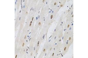 Immunohistochemistry of paraffin-embedded rat heart using KPNA4 Antibody (ABIN5971058) at dilution of 1/200 (40x lens). (KPNA4 抗体)