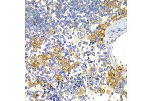 Immunohistochemistry of paraffin-embedded rat spleen using NOTCH1 antibody (ABIN5995370) at dilution of 1/100 (40x lens). (Notch1 抗体)