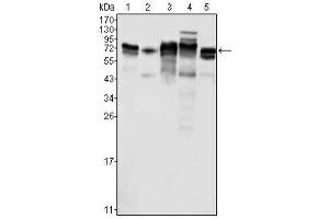 Western Blotting (WB) image for anti-Metadherin (MTDH) antibody (ABIN1108306) (MTDH 抗体)