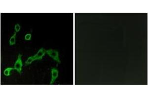 Immunofluorescence analysis of LOVO cells, using ADRA2A Antibody. (ADRA2A 抗体  (AA 281-330))