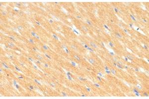 Immunohistochemistry of paraffin-embedded Rat heart using MYBPC3 Polyclonal Antibody at dilution of 1:100 (40x lens). (MYBPC3 抗体)