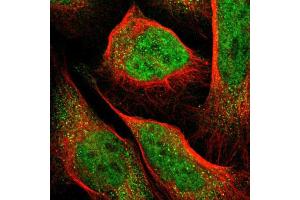 Immunofluorescent staining of U-2 OS cells using PCTK2 polyclonal antibody  shows positivity in cytoplasm and nucleus (green) but excluded from the nucleoli.