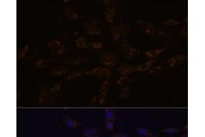 Immunofluorescence analysis of C6 cells using RGS4 Polyclonal Antibody at dilution of 1:100. (RGS4 抗体)