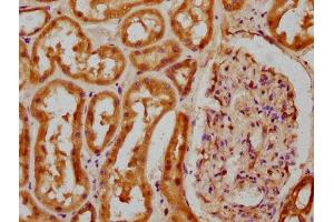 Immunohistochemistry (IHC) image for anti-Collagen, Type IV, alpha 5 (COL4A5) (AA 1184-1235) antibody (ABIN7148257)