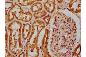 IHC image of ABIN7148257 diluted at 1:100 and staining in paraffin-embedded human kidney tissue performed on a Leica BondTM system. (COL4a5 抗体  (AA 1184-1235))