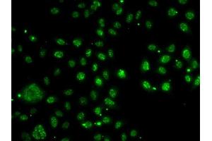 Immunofluorescence (IF) image for anti-Low Density Lipoprotein Receptor Adaptor Protein 1 (LDLRAP1) (AA 59-308) antibody (ABIN6143131)