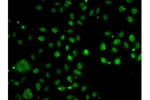 Immunofluorescence analysis of A-549 cells using LDLR antibody (ABIN6127366, ABIN6143131, ABIN6143132 and ABIN6222897). (LDLRAP1 抗体  (AA 59-308))