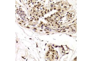 Immunohistochemistry of paraffin-embedded Human mammary gland using SNRPA antibody at dilution of 1:100 (x400 lens). (SNRPA1 抗体)