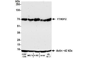 Western Blotting (WB) image for anti-YTH Domain Family, Member 2 (YTHDF2) (AA 300-350) antibody (ABIN7795701) (Recombinant YTHDF2 抗体  (AA 300-350))