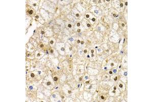 Immunohistochemistry of paraffin-embedded human liver injury using RAD9A antibody (ABIN5970971) at dilution of 1/200 (40x lens). (RAD9A 抗体)