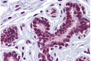 Human Breast: Formalin-Fixed, Paraffin-Embedded (FFPE) (KPNA4 抗体  (N-Term))