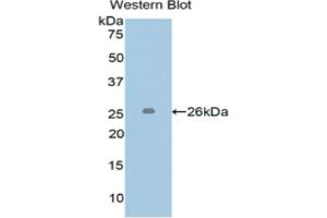 Western blot analysis of the recombinant protein. (L1CAM 抗体  (AA 218-423))