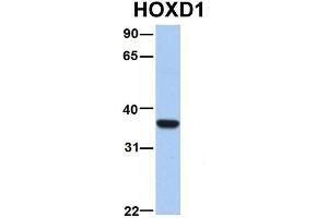 Host:  Rabbit  Target Name:  ETV5  Sample Type:  Human Fetal Liver  Antibody Dilution:  1. (ETV5 抗体  (N-Term))