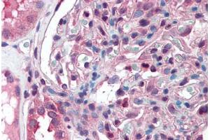Anti-SLC39A14 antibody  ABIN960809 IHC staining of human kidney. (SLC39A14 抗体  (Cytoplasmic Domain))