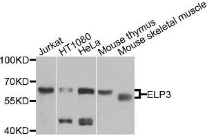 Western blot analysis of extracts of various cells, using ELP3 antibody. (ELP3/KAT9 抗体)