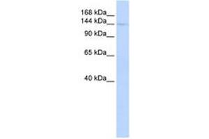 Image no. 1 for anti-Class II, Major Histocompatibility Complex, Transactivator (CIITA) (C-Term) antibody (ABIN6742736)