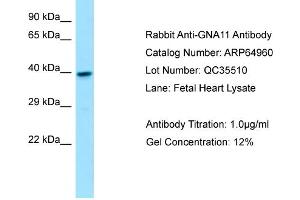 Western Blotting (WB) image for anti-Guanine Nucleotide Binding Protein (G Protein), alpha 11 (Gq Class) (GNA11) (N-Term) antibody (ABIN2790006)
