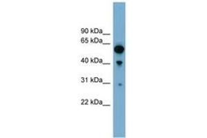 Image no. 1 for anti-rho GTPase Activating Protein 15 (ARHGAP15) (AA 251-300) antibody (ABIN6744151) (ARHGAP15 抗体  (AA 251-300))