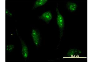Immunofluorescence of monoclonal antibody to SOLH on HeLa cell. (Calpain 15/SOLH 抗体  (AA 993-1086))